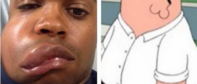 delino-deshields-jr-shows-off-swollen-face-after-being-hit-by-90mph-pitch-0419-8