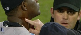 michael-pineda-ejected-pine-tar-0423-1