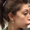 farrah-abraham-suffers-botched-lip-surgery-0107-2