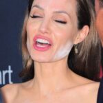 Angelina Jolie: What Happened to Your Face