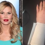 Brandi Glanville Injured By Hoverboard