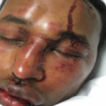 OVO Member Mo-G Beatdown over Drake