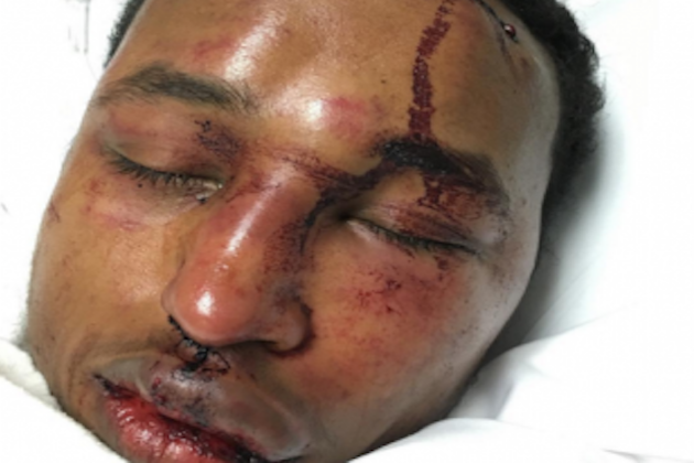 OVO Member Mo-G Beatdown over Drake