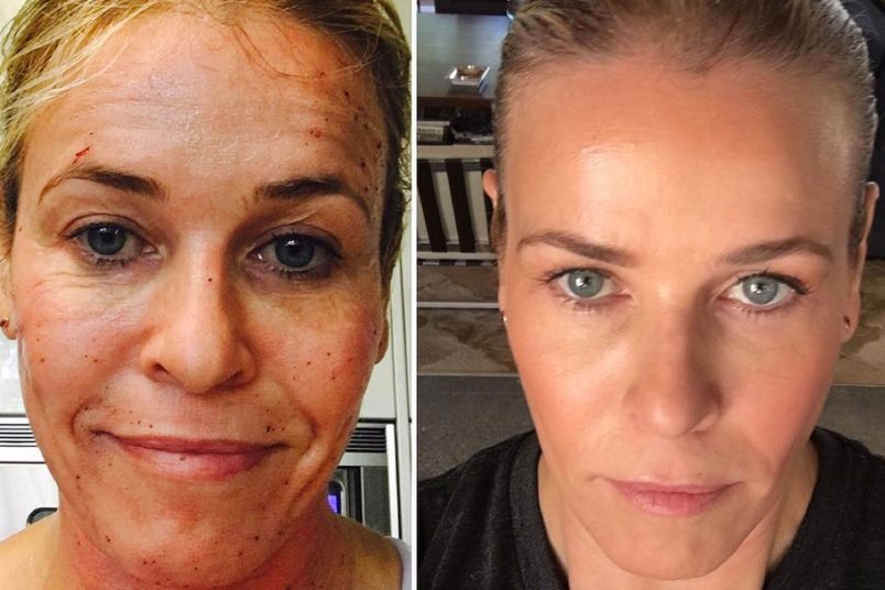 What Happened to Chelsea Handler