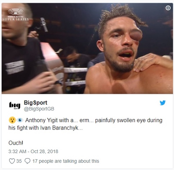 Boxer Anthony Yigit Eye Injury Swells to Size of Baseball