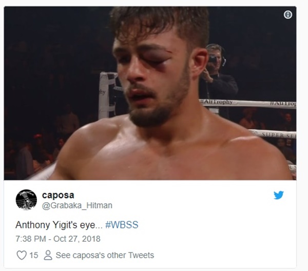 Boxer Anthony Yigit Eye Injury Swells to Size of Baseball