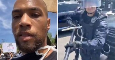 "Insecure" Star Hit By Baton-Wielding Cop During Peaceful Protest