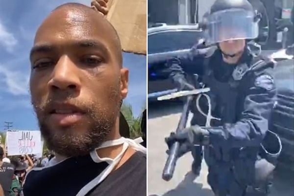 "Insecure" Star Hit By Baton-Wielding Cop During Peaceful Protest