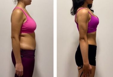 Struggling With Stubborn Fat? Why Mitolyn Is The Weight Loss Breakthrough