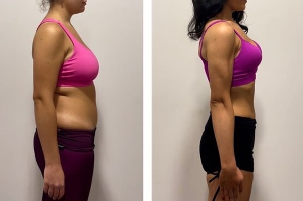 Struggling With Stubborn Fat? Why Mitolyn Is The Weight Loss Breakthrough